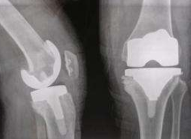 红足1—世足球网